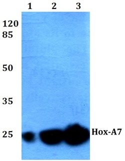 Invitrogen HOXA7 Polyclonal Antibody 100 &mu;L | Buy Online | Invitrogen&trade; | Fisher Scientific