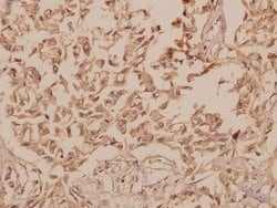 Invitrogen hnRNP H2 Polyclonal Antibody 100 &mu;L | Buy Online | Invitrogen&trade; | Fisher Scientific