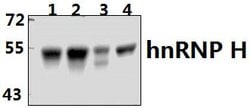 Invitrogen hnRNP H2 Polyclonal Antibody 100 &mu;L | Buy Online | Invitrogen&trade; | Fisher Scientific
