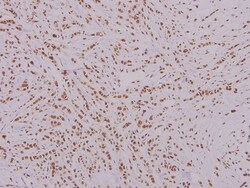 Invitrogen FOXK1 Polyclonal Antibody 100 &mu;L; Unconjugated:Antibodies,