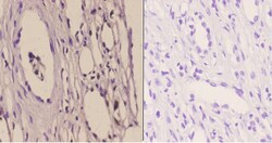 GTF2H2 Polyclonal Antibody:Antibodies, Polyclonal