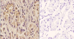 Invitrogen SIAH1/SIAH2 Polyclonal Antibody 100 &mu;L; Unconjugated:Antibodies,
