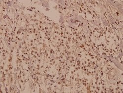 Invitrogen CUG-BP Polyclonal Antibody 100 &mu;L; Unconjugated:Antibodies,