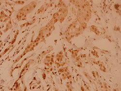 Invitrogen NPM1 Polyclonal Antibody 100 &mu;L; Unconjugated:Antibodies,