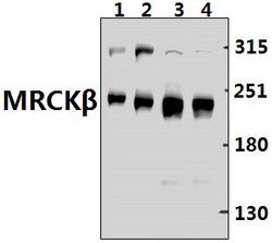 Invitrogen MRCK beta Polyclonal Antibody 100 &mu;L; Unconjugated:Antibodies,