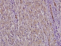 Invitrogen NFYC Polyclonal Antibody 100 &mu;L; Unconjugated:Antibodies,