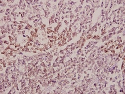 Invitrogen MID1 Polyclonal Antibody 100 &mu;L; Unconjugated:Antibodies,