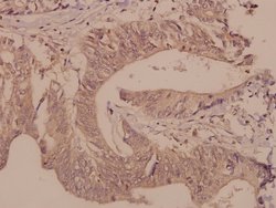 Invitrogen DGKQ Polyclonal Antibody 100 &mu;L | Buy Online | Invitrogen&trade; | Fisher Scientific