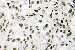 Invitrogen VPS72 Polyclonal Antibody 100 &mu;L; Unconjugated:Antibodies,