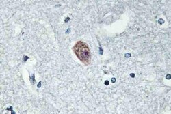 Invitrogen DOK6 Polyclonal Antibody 100 &mu;L; Unconjugated:Antibodies,
