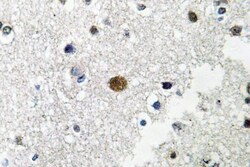 Invitrogen BRF1 Polyclonal Antibody 100 &mu;L | Buy Online | Invitrogen&trade; | Fisher Scientific