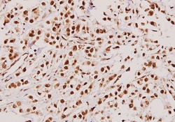 Invitrogen TACC3 Polyclonal Antibody 100 &mu;L; Unconjugated:Antibodies,