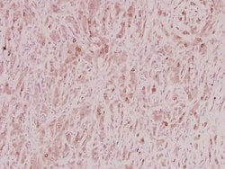 Invitrogen ZNF23 Polyclonal Antibody 100 &mu;L; Unconjugated:Antibodies,