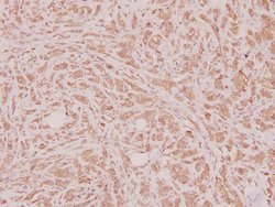 Invitrogen HOXD12 Polyclonal Antibody 100 &mu;L; Unconjugated:Antibodies,