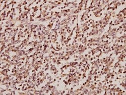 Invitrogen SRSF4 Polyclonal Antibody 100 μL; Unconjugated:Antibodies,