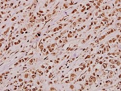 Invitrogen JIP3 Polyclonal Antibody 100 &mu;L; Unconjugated:Antibodies,