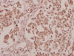 Invitrogen CEP135 Polyclonal Antibody 100 &mu;L; Unconjugated:Antibodies,