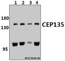 Invitrogen CEP135 Polyclonal Antibody 100 &mu;L; Unconjugated:Antibodies,