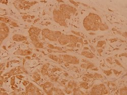 Invitrogen Cerebral Protein 1 Polyclonal Antibody 100 &mu;L; Unconjugated:Antibodies,