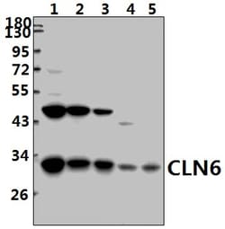 CLN6 Polyclonal Antibody, Invitrogen 100 &mu;L | Buy Online | Invitrogen | Fisher Scientific
