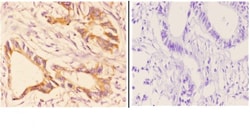 Invitrogen CHPF Polyclonal Antibody 100 &mu;L; Unconjugated:Antibodies,