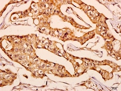 Invitrogen GNPAT Polyclonal Antibody 100 &mu;L; Unconjugated:Antibodies,