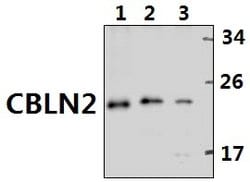 Invitrogen Cerebellin 2 Polyclonal Antibody 100 &mu;L; Unconjugated:Antibodies,