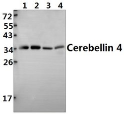 Invitrogen Cerebellin 4 Polyclonal Antibody 100 &mu;L; Unconjugated:Antibodies,
