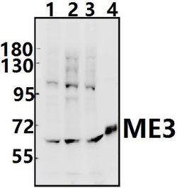 Invitrogen ME3 Polyclonal Antibody 100 &mu;L | Buy Online | Invitrogen&trade; | Fisher Scientific