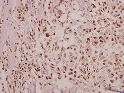 Invitrogen POM121 Polyclonal Antibody 100 &mu;L; Unconjugated:Antibodies,