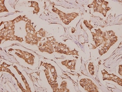 DDX52 Polyclonal Antibody:Antibodies, Polyclonal