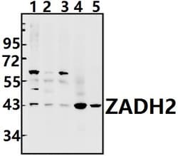 Invitrogen ZADH2 Polyclonal Antibody 100 &mu;L; Unconjugated:Antibodies,