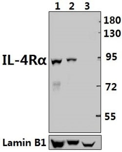 Invitrogen IL4R Polyclonal Antibody 100 &mu;L; Unconjugated:Antibodies,