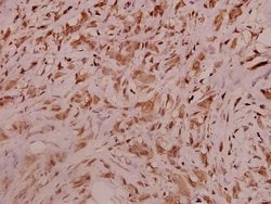 Invitrogen Sodium Channel Pan Polyclonal Antibody 100 &mu;L; Unconjugated:Antibodies,