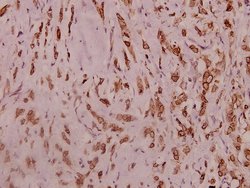 Invitrogen SCN2A Polyclonal Antibody 100 &mu;L | Buy Online | Invitrogen&trade; | Fisher Scientific
