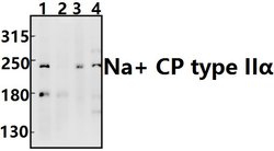 Invitrogen SCN2A Polyclonal Antibody 100 &mu;L | Buy Online | Invitrogen&trade; | Fisher Scientific