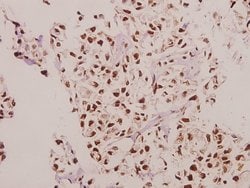 Invitrogen CPI-17 Polyclonal Antibody 100 &mu;L; Unconjugated:Antibodies,