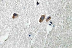 Invitrogen CaMKII beta/gamma/delta Polyclonal Antibody 100 &mu;L; Unconjugated:Antibodies,