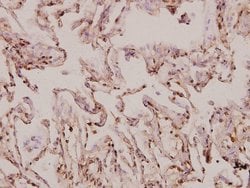 Invitrogen MRPS9 Polyclonal Antibody 100 &mu;L; Unconjugated:Antibodies,