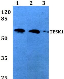Invitrogen TESK1 Polyclonal Antibody 100 &mu;L; Unconjugated:Antibodies,