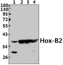 Invitrogen HOXB2 Polyclonal Antibody 100 &mu;L; Unconjugated:Antibodies,