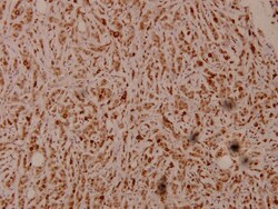 Invitrogen PEX7 Polyclonal Antibody 100 &mu;L; Unconjugated:Antibodies,