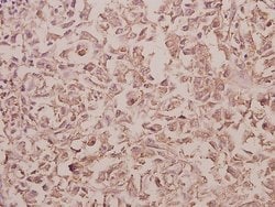 Invitrogen RAB5C Polyclonal Antibody 100 μL; Unconjugated:Antibodies,