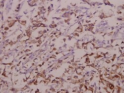 Invitrogen OATP1 Polyclonal Antibody 100 &mu;L | Buy Online | Invitrogen&trade; | Fisher Scientific