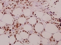 Invitrogen SFRS15 Polyclonal Antibody 100 &mu;L | Buy Online | Invitrogen&trade; | Fisher Scientific