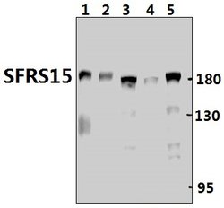 Invitrogen SFRS15 Polyclonal Antibody 100 &mu;L | Buy Online | Invitrogen&trade; | Fisher Scientific