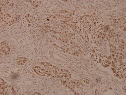 Invitrogen ZP1 Polyclonal Antibody 100 &mu;L; Unconjugated:Antibodies,