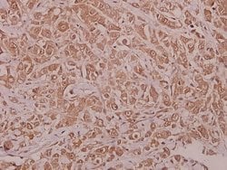 Invitrogen Phospho-AMPK alpha-1 (Ser486) Polyclonal Antibody 100 &mu;L;