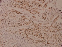 Invitrogen Phospho-Androgen Receptor (Ser650) Polyclonal Antibody 100 &mu;L;