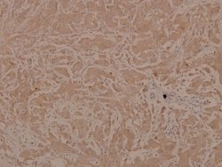 Invitrogen Phospho-ASK1 (Ser83) Polyclonal Antibody 100 &mu;L; Unconjugated:Antibodies,
